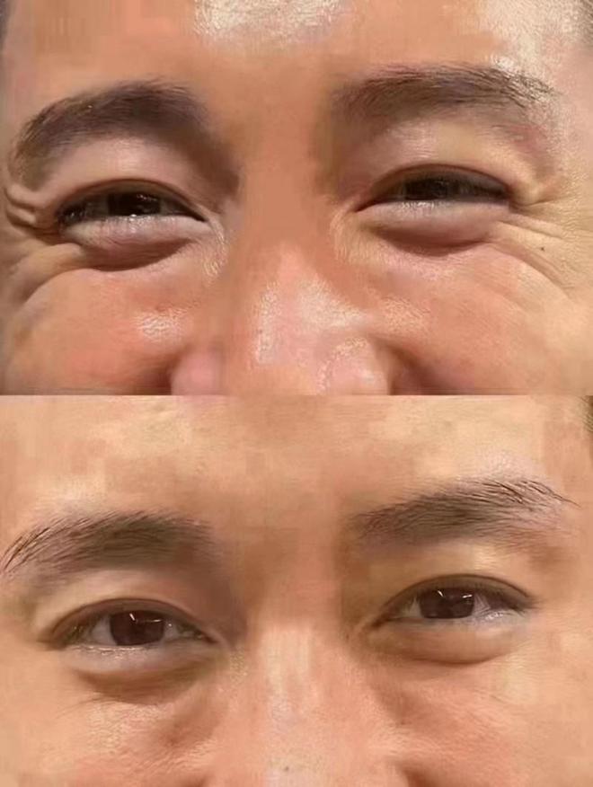 荐专业抗皱绽放自信笑容OG真人抗皱护肤品推(图5)
