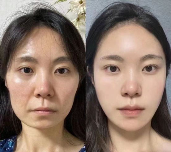 荐专业抗皱绽放自信笑容OG真人抗皱护肤品推(图7)